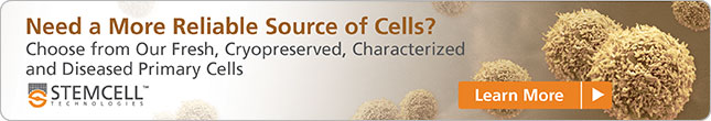Need a more reliable source of cells? Choose from our range of primary cells. Learn more!